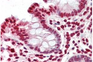 Human Colon: Formalin-Fixed, Paraffin-Embedded (FFPE) (YPEL4 antibody  (N-Term))
