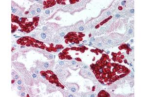 Anti-GYPA / Glycophorin A antibody IHC of human kidney, red blood cells. (CD235ab antibody)