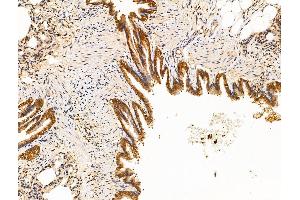 ABIN7094623 and ABIN7098673 at 1/100 staining Rat lung tissue by IHC-P. (MTDH antibody  (C-Term))