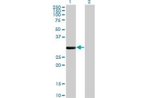 Western Blot analysis of FCN1 expression in transfected 293T cell line by FCN1 monoclonal antibody (M06), clone 2B7.