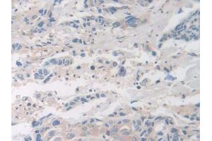 Used in DAB staining on fromalin fixed paraffin- embedded glioma tissue (Factor VIII antibody  (AA 1887-2044))