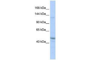 KIAA0319L antibody used at 1 ug/ml to detect target protein. (KIAA0319L antibody  (Middle Region))