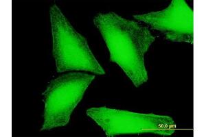Immunofluorescence of purified MaxPab antibody to CRY2 on HeLa cell. (CRY2 antibody  (AA 1-593))