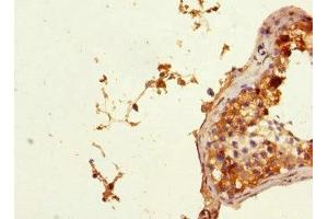Immunohistochemistry of paraffin-embedded human testis tissue using ABIN7163046 at dilution of 1:100 (PHF11 antibody  (AA 1-292))
