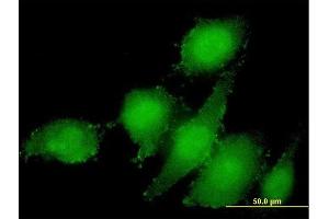 Immunofluorescence of monoclonal antibody to STAMBP on HeLa cell.