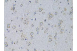 Immunohistochemistry of paraffin-embedded rat brain using GARS antibody (ABIN1876623) at dilution of 1:100 (40x lens). (GARS antibody)