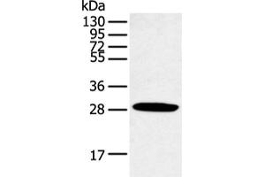 Western blot analysis of Human normal lung tissue using CLDN25 Polyclonal Antibody at dilution of 1:250 (CLDN25 antibody)