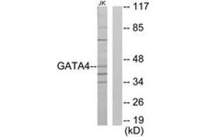 Western Blotting (WB) image for anti-GATA Binding Protein 4 (GATA4) (AA 271-320) antibody (ABIN2889481) (GATA4 antibody  (AA 271-320))