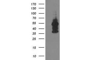 HEK293T cells were transfected with the pCMV6-ENTRY control (Left lane) or pCMV6-ENTRY DOK2 (Right lane) cDNA for 48 hrs and lysed. (DOK2 antibody)