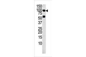 Western blot analysis of anti-RK4 Pab (ABIN391222 and ABIN2841295) in mouse liver tissue lysate (35 μg/lane). (MARK4 antibody  (C-Term))