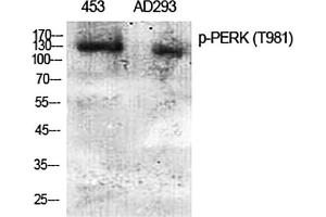 Western Blot analysis of 453(1), AD293(2), diluted at 1:2000. (PERK antibody  (pThr981))