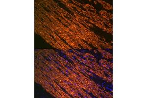 Immunofluorescence analysis of smooth muscle of human colon carcinoma using α-Smooth Muscle Actin  Rabbit mAb (ABIN7265392) at dilution of 1:100 (40x lens). (Smooth Muscle Actin antibody)