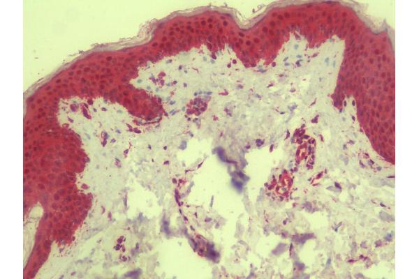 TMPRSS11A antibody  (C-Term)