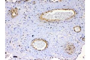 IHC testing of FFPE human placenta tissue with VEGFR2 antibody at 1ug/ml. (VEGFR2/CD309 antibody)