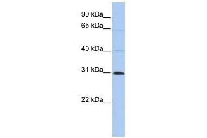 C1ORF184 antibody used at 1 ug/ml to detect target protein. (METTL11B antibody  (C-Term))