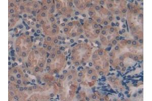 DAB staining on IHC-P; Samples: Mouse Kidney Tissue (AMBP antibody  (AA 18-202))