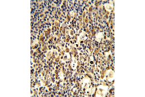 Immunohistochemistry (IHC) image for anti-Fc Fragment of IgG, High Affinity Ib, Receptor (CD64) (FCGR1B) (AA 248-276), (C-Term) antibody (ABIN5538868)