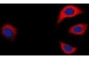 Immunofluorescent analysis of GAB1 staining in K562 cells. (GAB1 antibody  (C-Term))