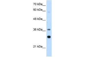 RPLP0 antibody used at 2. (RPLP0 antibody  (Middle Region))