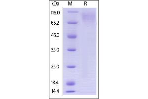 Biotinylated Human CEACAM-1, Avitag,His Tag on  under reducing (R) condition. (CEACAM1 Protein (AA 35-428) (His tag,AVI tag,Biotin))