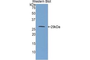 Western blot analysis of the recombinant protein. (IGF2R antibody  (AA 1146-1363))