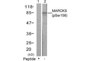 Western blot analysis of extracts from 3T3 cells using MARCKS(Phospho-Ser158) Antibody(Lane 2) and the same antibody preincubated with blocking peptide(Lane1). (MARCKS antibody  (pSer158))