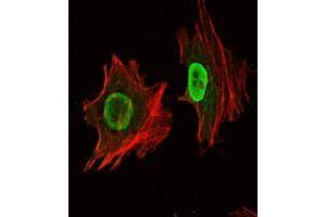 Immunofluorescence analysis of NTERA-2 cells using POU5F1 monoclonal antobody, clone 7E7  (green).