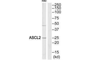 Western blot analysis of extracts from K562 cells, using ASCL2 antibody.