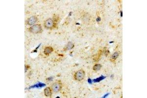 Immunohistochemical analysis of Alpha-1A Adrenergic Receptor staining in human brain formalin fixed paraffin embedded tissue section. (alpha 1 Adrenergic Receptor antibody  (C-Term))