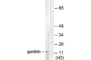 Western blot analysis of extracts from NIH/3T3 cells, using Gastrin antibody (#C0205). (Gastrin antibody)