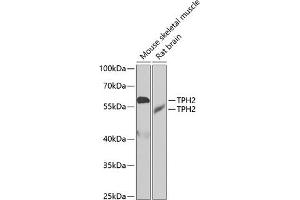 Western blot analysis of extracts of various cell lines, using TPH2 antibody (ABIN6133469, ABIN6149436, ABIN6149437 and ABIN6222965) at 1:1000 dilution. (Tryptophan Hydroxylase 2 antibody  (AA 1-170))