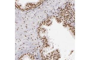 Immunohistochemical staining of human prostate with PAPOLA polyclonal antibody  shows moderate nuclear positivity in glandular cells at 1:50-1:200 dilution. (PAPOLA antibody)
