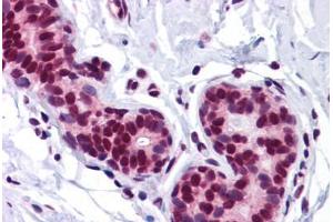 Human Breast: Formalin-Fixed, Paraffin-Embedded (FFPE) (FOXO3 antibody  (N-Term))
