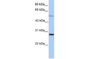 WB Suggested Anti-MXD1 Antibody Titration:  0. (MXD1 antibody  (N-Term))