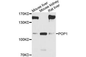 Western blot analysis of extracts of various cell lines, using POP1 antibody (ABIN5973549) at 1/1000 dilution. (POP1 antibody)