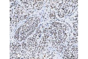 IHC analysis of CPSF6 using anti-CPSF6 antibody (ABIN7601897).
