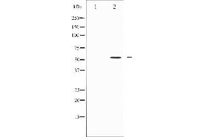 Western Blotting (WB) image for anti-SMAD, Mothers Against DPP Homolog 3 (SMAD3) (C-Term) antibody (ABIN6265173)