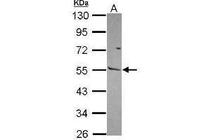 WB Image Sample (30 ug of whole cell lysate) A: NT2D1 10% SDS PAGE antibody diluted at 1:1000 (MMP13 antibody)