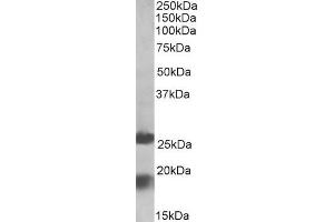 ABIN571250 (2µg/ml) staining of Human Frontal Cortex lysate (35µg protein in RIPA buffer). (MPV17 antibody  (Internal Region))