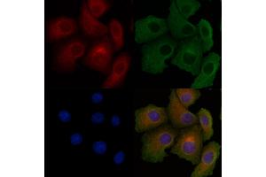 ABIN6260457 and ABIN6278556 staining Hela cells by IF/ICC. (CARD10 antibody  (N-Term))