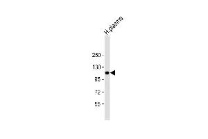 Anti-ITIH4 Antibody (C-Term) at 1:2000 dilution + human plasma lysate Lysates/proteins at 20 μg per lane. (ITIH4 antibody  (AA 784-816))