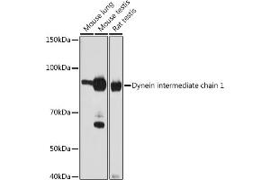 Western blot analysis of extracts of various cell lines, using Dynein intermediate chain 1 antibody (ABIN1681261, ABIN7101535, ABIN7101536 and ABIN7101537) at 1:1000 dilution. (DNAI1 antibody)