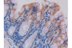 Used in DAB staining on fromalin fixed paraffin- embedded intestine tissue (HEXB antibody  (AA 294-435))