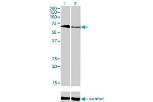 Western blot analysis of TBX5 over-expressed 293 cell line, cotransfected with TBX5 Validated Chimera RNAi (Lane 2) or non-transfected control (Lane 1). (T-Box 5 antibody  (AA 402-518))