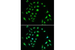 Immunofluorescence analysis of A549 cell using CHUK antibody. (IKK alpha antibody)