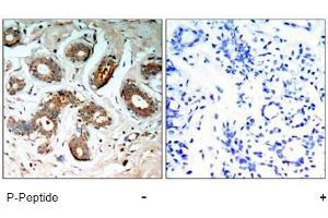 Image no. 1 for anti-14-3-3 zeta (YWHAZ) (pSer58) antibody (ABIN196916) (14-3-3 zeta antibody  (pSer58))