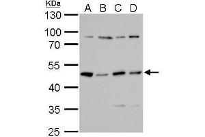WB Image PKA R2 antibody detects PKA R2 protein by Western blot analysis. (PRKAR2A antibody  (Center))