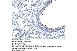 Human Lung (ZNF16 antibody  (N-Term))