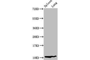 Western Blot Positive WB detected in: Rat spleen tissue, Rat lung tissue All lanes: S100a8 antibody at 3. (S1A8 (AA 2-89) antibody)