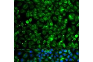 Immunofluorescence analysis of MCF-7 cells using TMLHE Polyclonal Antibody (TMLHE antibody)
